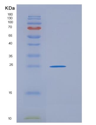 Recombinant Mouse GPA33 / Glycoprotein A33 Protein (His tag)
