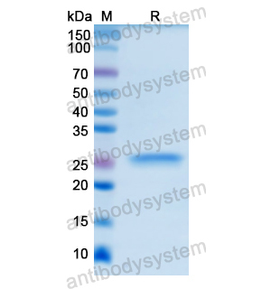 Recombinant Human ALOX5, N-His