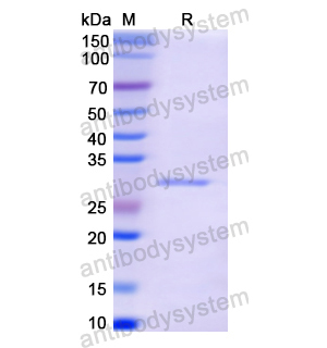 Recombinant Human ALDOC, N-His