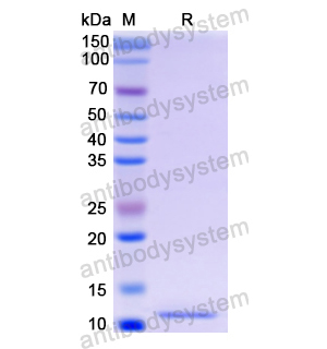 Recombinant Human C4A, N-His