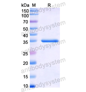 Recombinant Human C1QTNF9, N-His