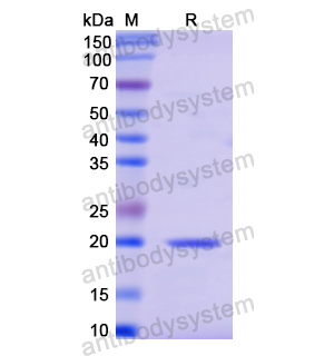 Recombinant Human POTEJ, N-His