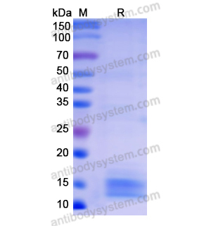 Recombinant Human SAA2, N-His