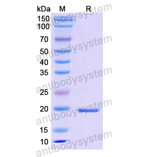 Recombinant Human CALM1, N-His