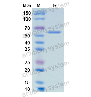 Recombinant Human AMY1A, N-His