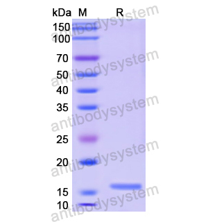 Recombinant Human CALCB, N-His