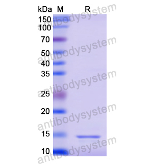 Recombinant Human RARA, N-His