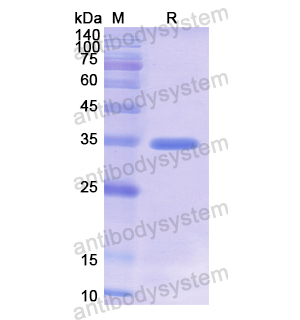 Recombinant Human ACR, N-His