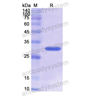 Recombinant Human ARAF, N-His
