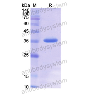 Recombinant Human OPN/SPP1, N-His
