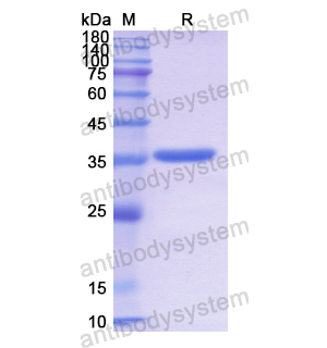 Recombinant Human COX5B, N-GST