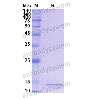 Recombinant Human MGST1, N-His