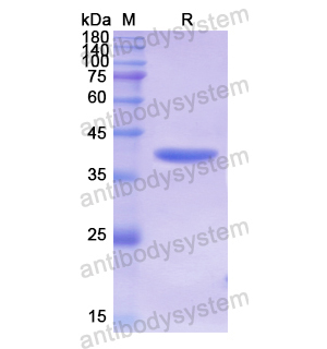 Recombinant Human C7, N-His