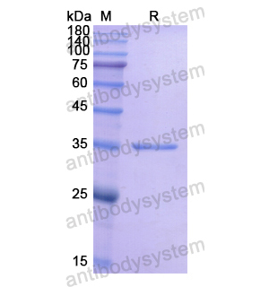 Recombinant Human CHGA, N-His