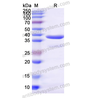 Recombinant Human RBP3, N-His