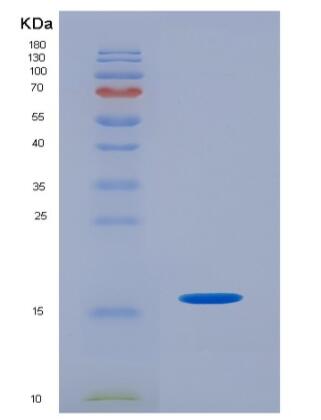 Eukaryotic T-Cell Surface Glycoprotein CD3 Epsilon (CD3e).