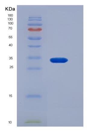 Recombinant Rat HAAO / 3-HAO Protein (His tag)