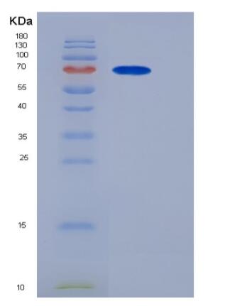 Recombinant Mouse PCSK9 / NARC1 Protein (His tag)