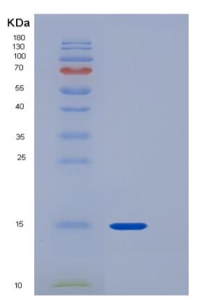 Recombinant Rat CD90 / THY-1 Protein (His tag)