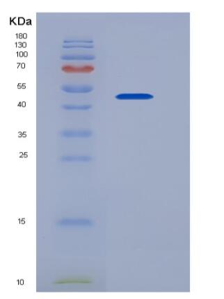 Recombinant Mouse SLC3A2 / CD98 Protein (His tag)