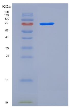 Recombinant Rat TrkB / NTRK2 Protein (Fc tag)