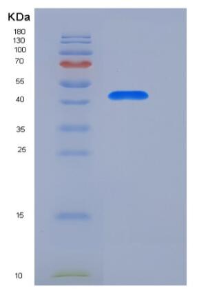 Recombinant Human Renin Protein (His tag)