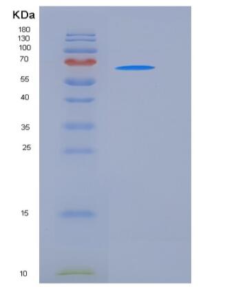Recombinant Rat CD111 / Nectin-1 / PVRL1 Protein (Fc tag)