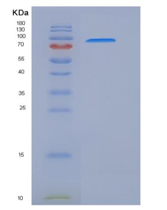 Recombinant Rat HER2 / ErbB2 Protein (Fc tag)