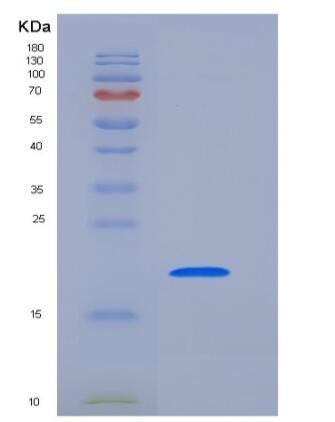 Recombinant Human PTH1R Protein (His Tag)