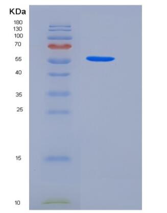 Recombinant Human tPA / PLAT Protein (Fc tag)