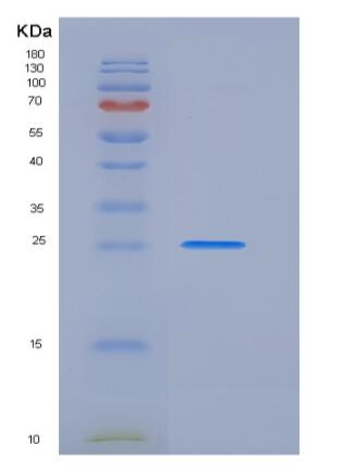 Recombinant Rat PRLR / Prolactin receptor Protein (His tag)