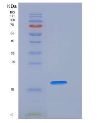 Recombinant Human Fas Protein (His Tag)