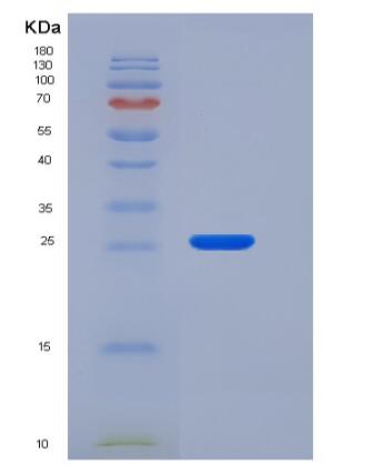 Recombinant Human CLM-9 / TREM4 / CD300LG Protein (His tag)