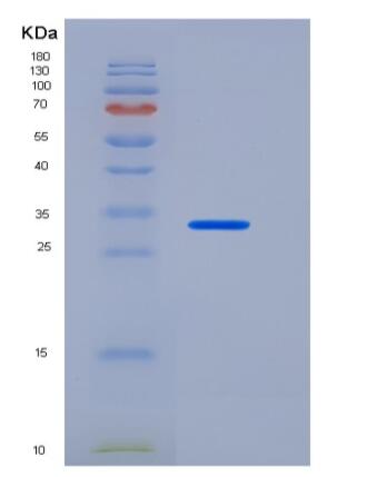 Recombinant Human CEACAM8 / CD66b Protein (His tag)