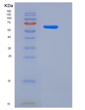Recombinant Rat Galectin-8 / LGALS8 Protein (GST tag)