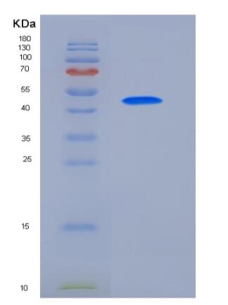 Recombinant Human ULBP2 / N2DL-2 Protein (Fc tag)