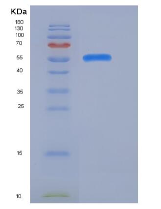 Recombinant Mouse CD166 / ALCAM Protein (His Tag)