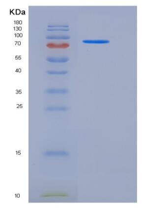 Recombinant Mouse ALCAM / CD166 Protein (His & Fc tag)