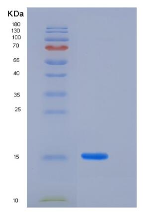 Recombinant Human LAIR2 / CD306 Protein
