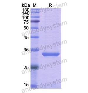 Recombinant Human ESD, N-His