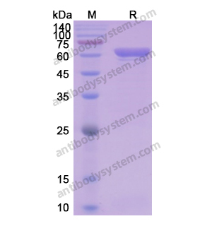 Recombinant Human HSPD1, N-His