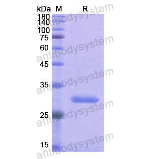 Recombinant Human RARB, N-His