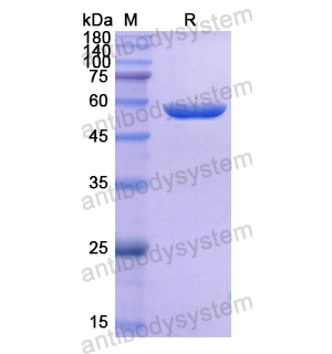 Recombinant Human THRA, N-His