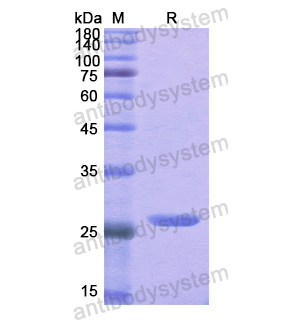 Recombinant Human THRB, N-His