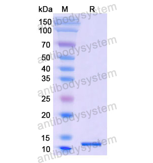 Recombinant Human SLC2A1, N-His