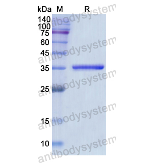 Recombinant Human EPB41, N-His