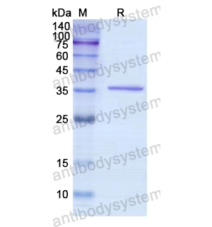 Recombinant Human PDHB, N-His