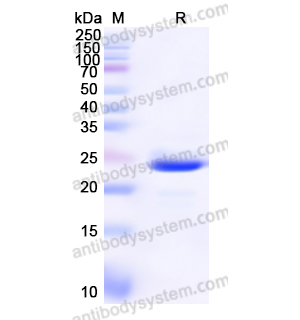 Recombinant Human CD11b/ITGAM, N-His
