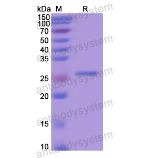 Recombinant Human MBL2, N-His