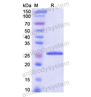 Recombinant Human RALA, N-His